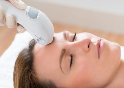 microneedling mit exosomen