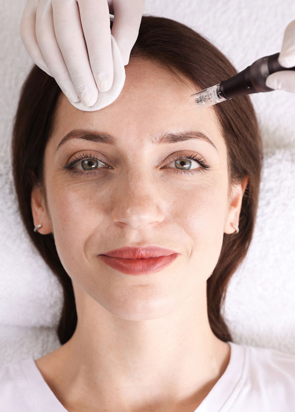 microneedling mit vitamin booster glow