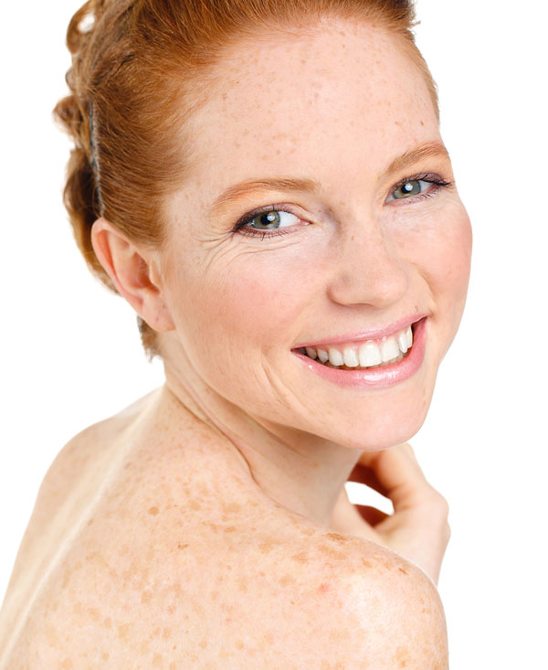rosacea behandlung glow 2